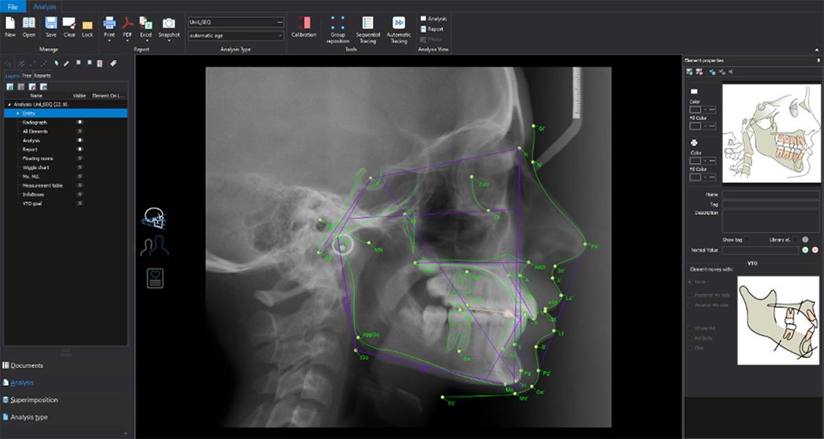 Bone Topography CBCT ORIS Radiology Richmond Hill